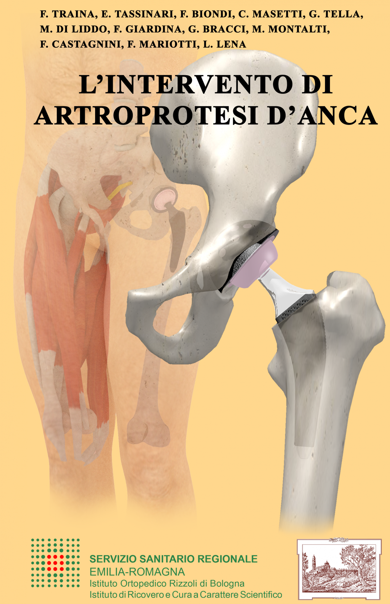 Artroprotesi d'anca