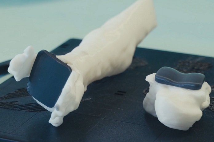 La protesi di caviglia stampata in 3D