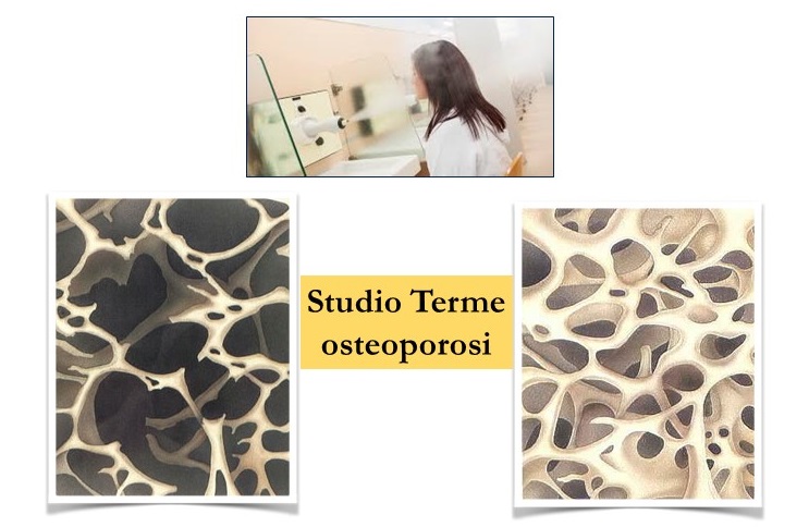 Cure termali inalatorie per contrastare l'osteoporosi
