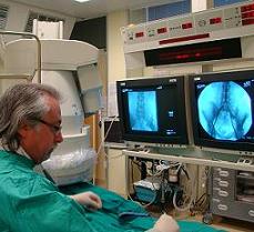 Sala angiografica: procedura embolizzante in corso