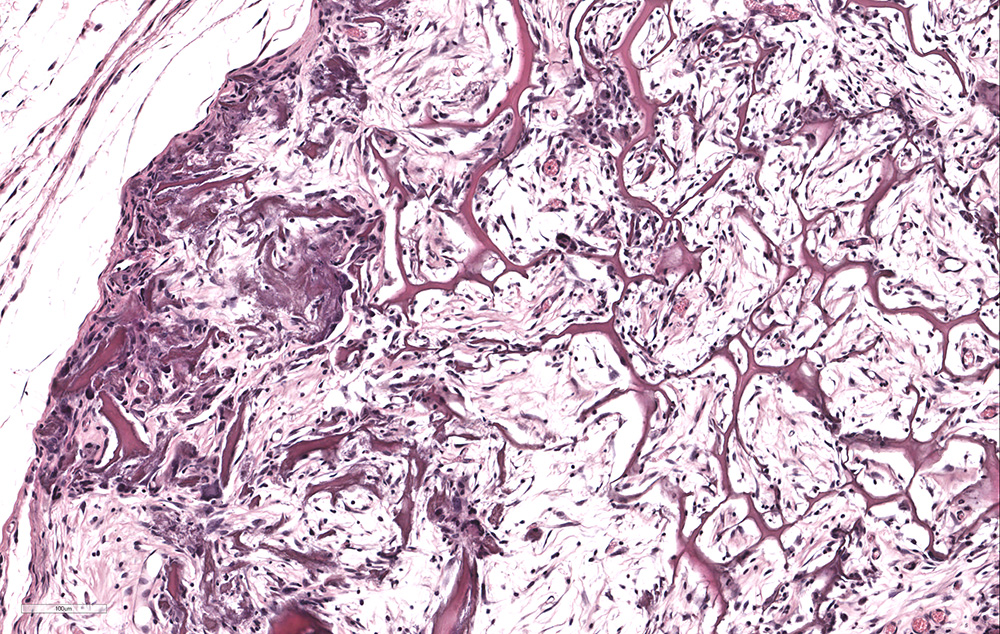 Fig. 3 - Immagine istologica di impianto sottocutaneo di scaffold bifasico a base collagenica arricchito con cellule mesenchimali staminali umane. Colorazione Ematossilina-Eosina, ingrandimento 20x