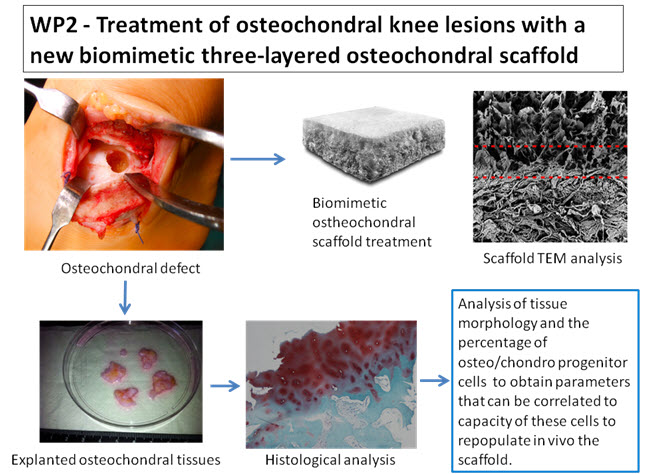 Treatment of osteochondral knee lesions with a new biomimetic three-layered osteochondral scaffold