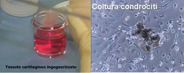 coltura condrociti coltura condrociti