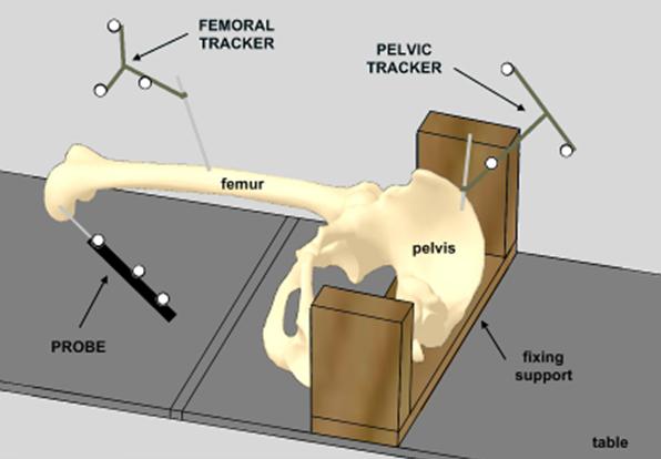 Fig. 3 – Setup per acquisizione della cinematica e della stabilità nell’articolazione dell’anca Fig. 3 – Setup per acquisizione della cinematica e della stabilità nell’articolazione dell’anca