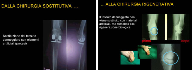 dalla chirurgia sostitutiva a quella ricostruttiva
