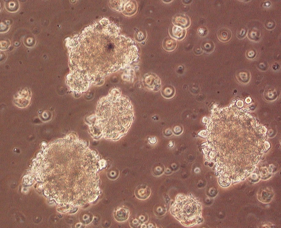 Spheroid culture, rich in stem cells from alveolar rhabdomyosarcoma