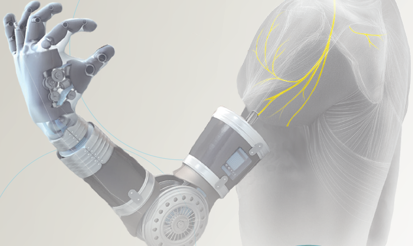 Osseointegration and Bionic Limb Reconstruction (brochure image)