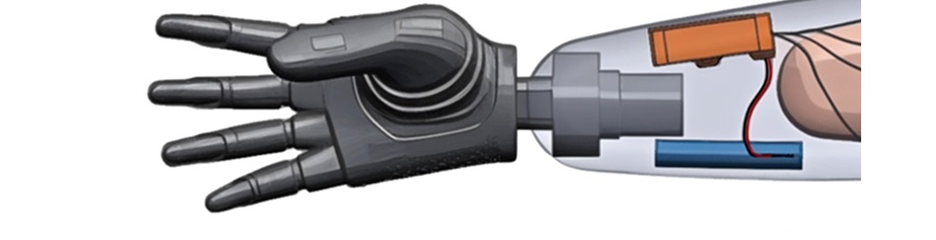 Disegno protesi di mano di ultima generazione