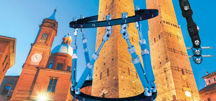 Evento Fissazione Esterna