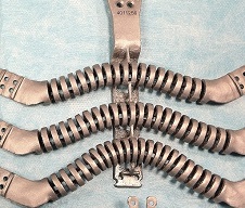 Immagine della protesi di sterno in titanio stampata in 3D