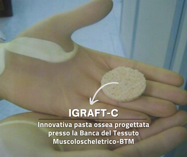 Pasta IGRAFT-C progettata presso la BTM