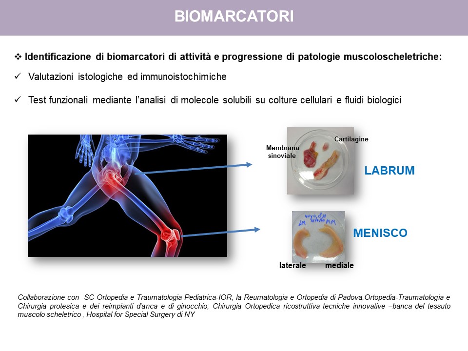 Figure 8: Identification of biomarkers of activity and progression of musculoskeletal disorders