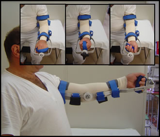 Fig 9: Immobilization tutor: allows a gradual and progressive increase of the movement arch, thanks to the mechanic zip