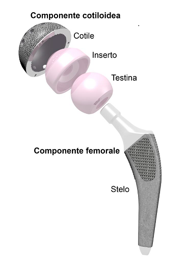 Fig. 1 - Composizione della protesi in titanio