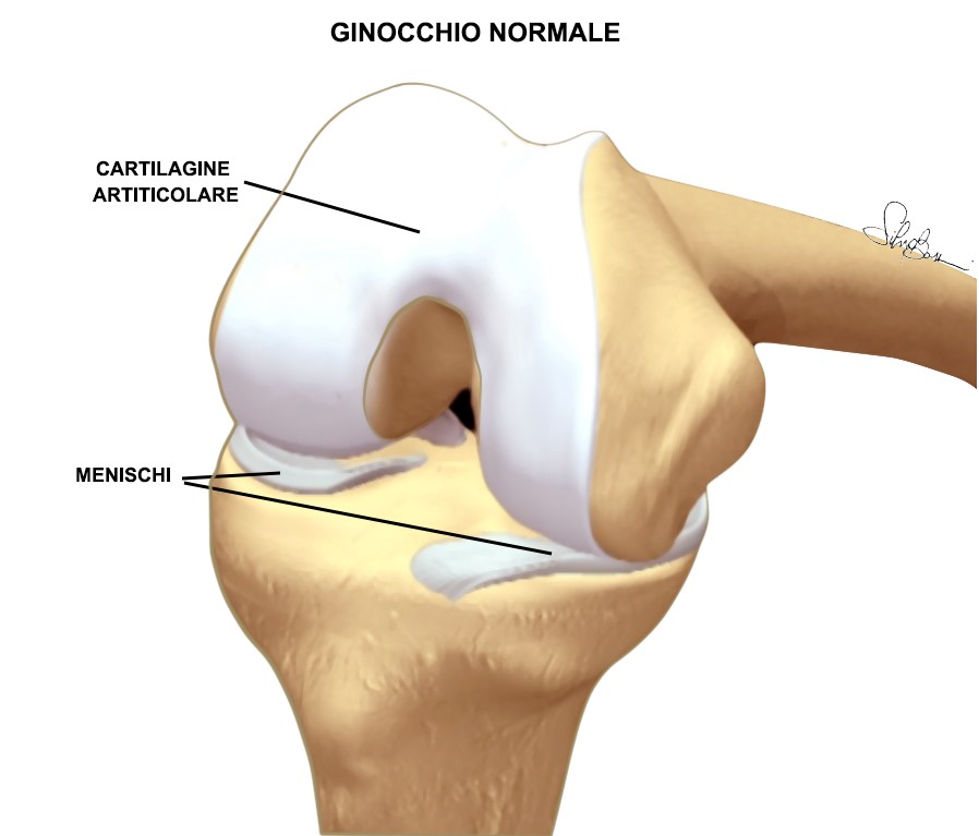 Fig. 1 - Ginocchio normale.