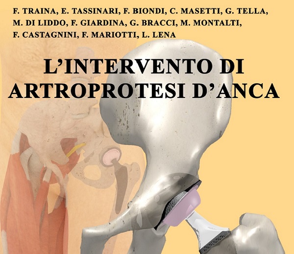 Copertina dell'opuscolo "L'intervento di artroprotesi d'anca"
