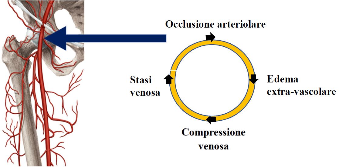 Figura 1: Anatomia vascolare dell’articolazione  coxo-femorale