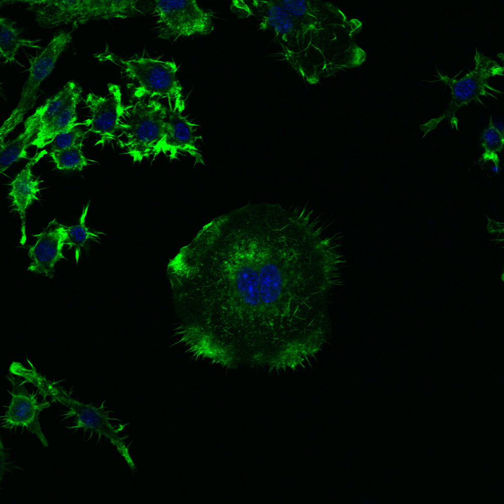 Fig. 2 - Osteoclasta murino osservato al microscopio confocale in cui sono evidenti i nuclei (blue) ed i filamenti di actina (verde) nei podosomi