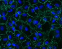 Figure 2 - HUVEC expression of Ve-cadherin