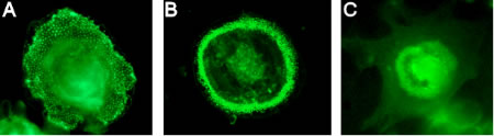 Figure 3 - Osteoclasts: different organization of the cytoskeleton on poly-dimethyl siloxane (A), glass (B), oxo (C) Figure 3 - Osteoclasts: different organization of the cytoskeleton on poly-dimethyl siloxane (A), glass (B), oxo (C)