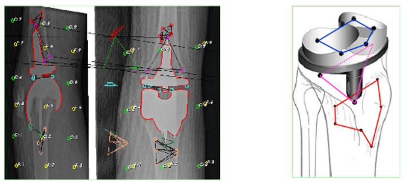 Fig. 3a-b: Determinazione delle coordinate 3D e corpi rigidi costituiti dai marker Fig. 3a-b: Determinazione delle coordinate 3D e corpi rigidi costituiti dai marker