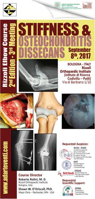 Locandina Convegno "Stiffness and Osteochondritis dissecans", Settembre 2017